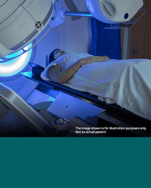 Radiotherapy