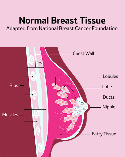 breast-cancer-about-mobile