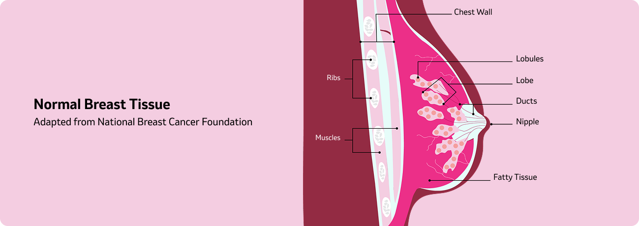 breast-cancer-about